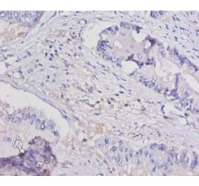 Immunohistochemistry - Interleukin-15 Polyclonal Antibody from Signalway Antibody (42462) - Antibodies.com