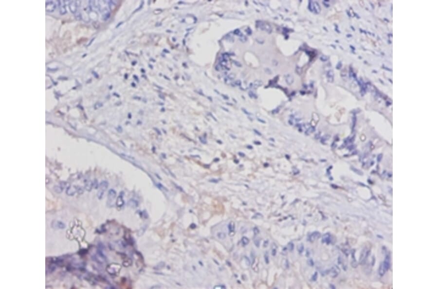 Immunohistochemistry - Interleukin-15 Polyclonal Antibody from Signalway Antibody (42462) - Antibodies.com