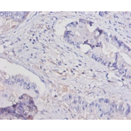 Immunohistochemistry - Interleukin-15 Polyclonal Antibody from Signalway Antibody (42462) - Antibodies.com