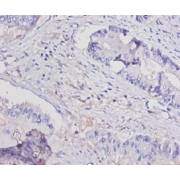 Immunohistochemistry - Interleukin-15 Polyclonal Antibody from Signalway Antibody (42462) - Antibodies.com