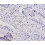 Immunohistochemistry - Interleukin-15 Polyclonal Antibody from Signalway Antibody (42462) - Antibodies.com