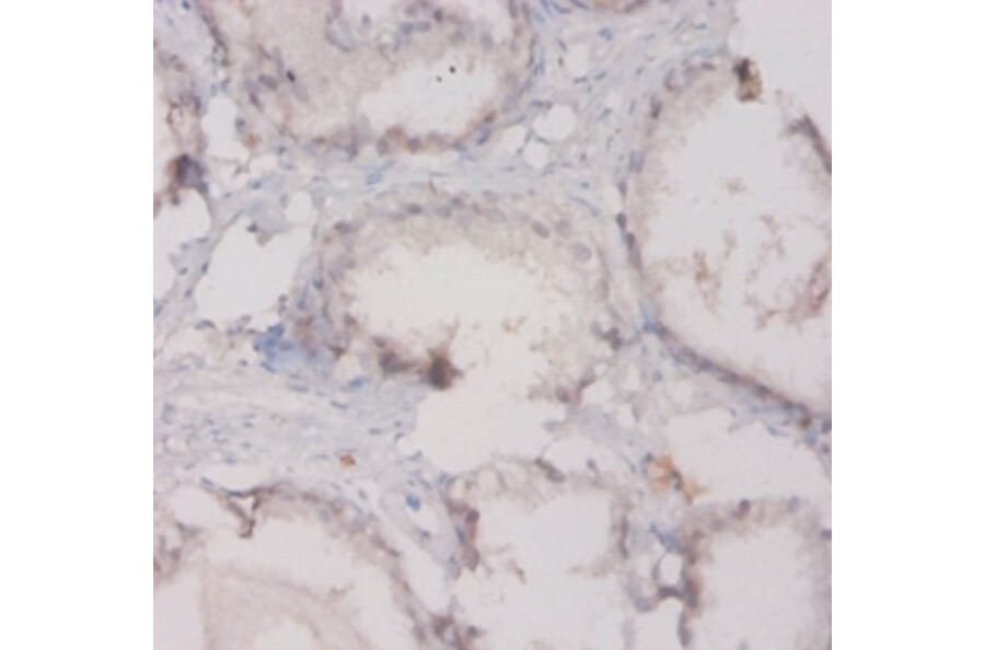 Immunohistochemistry - Complement C3 Polyclonal Antibody; from Signalway Antibody (42525) - Antibodies.com