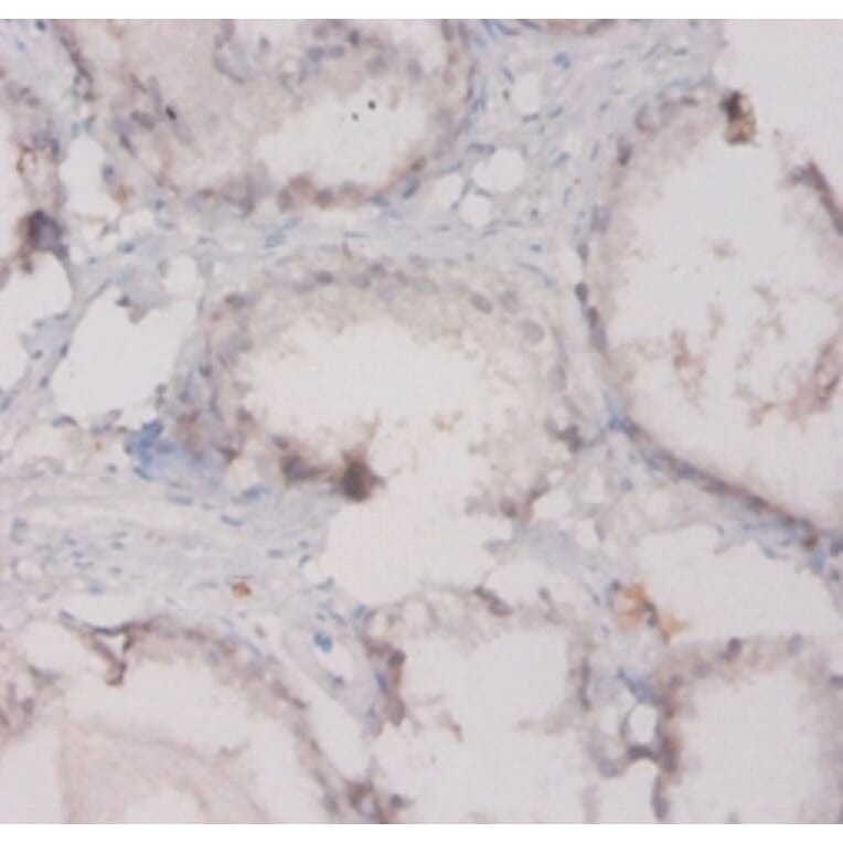 Immunohistochemistry - Complement C3 Polyclonal Antibody; from Signalway Antibody (42525) - Antibodies.com