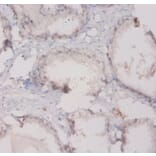 Immunohistochemistry - Complement C3 Polyclonal Antibody; from Signalway Antibody (42525) - Antibodies.com