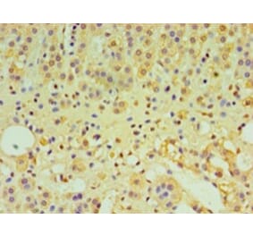 Immunohistochemistry - Interleukin-29 Polyclonal Antibody from Signalway Antibody (42566) - Antibodies.com