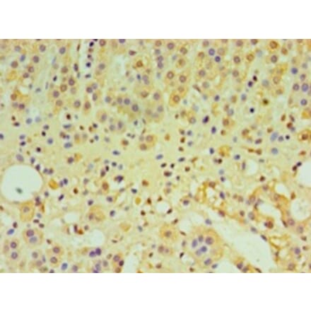 Immunohistochemistry - Interleukin-29 Polyclonal Antibody from Signalway Antibody (42566) - Antibodies.com