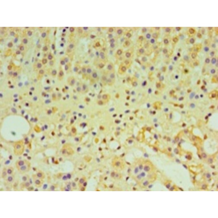 Immunohistochemistry - Interleukin-29 Polyclonal Antibody from Signalway Antibody (42566) - Antibodies.com