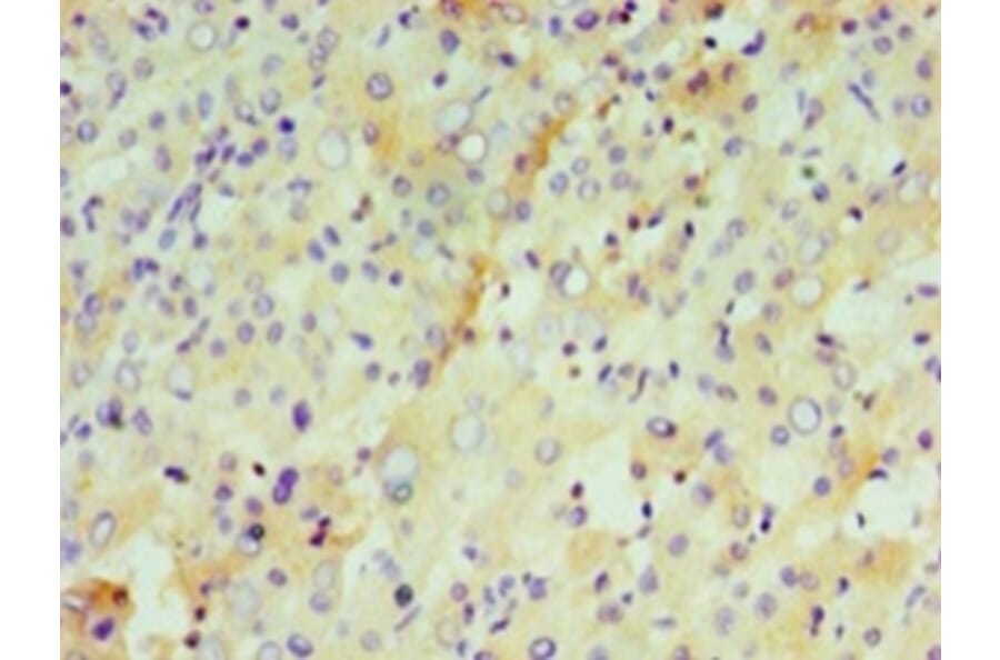 Immunohistochemistry - Interleukin-29 Polyclonal Antibody from Signalway Antibody (42566) - Antibodies.com