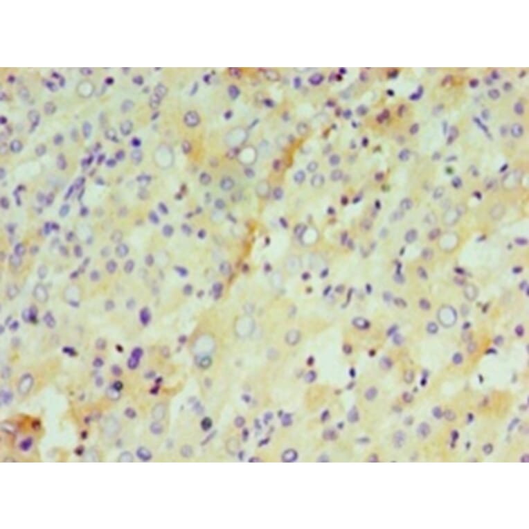 Immunohistochemistry - Interleukin-29 Polyclonal Antibody from Signalway Antibody (42566) - Antibodies.com