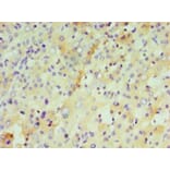 Immunohistochemistry - Interleukin-29 Polyclonal Antibody from Signalway Antibody (42566) - Antibodies.com