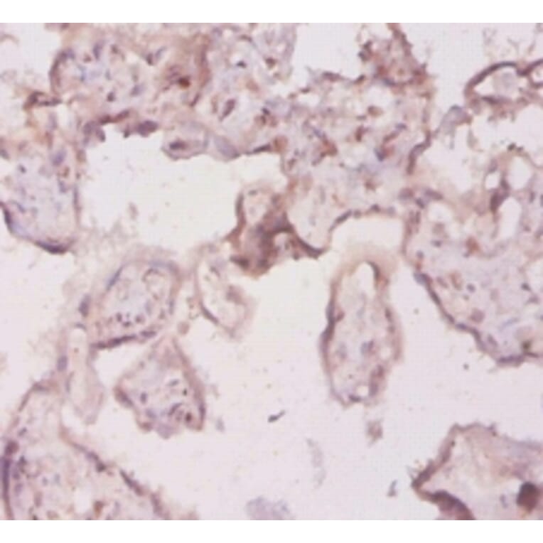 Immunohistochemistry - interleukin 18 Polyclonal Antibody from Signalway Antibody (42647) - Antibodies.com