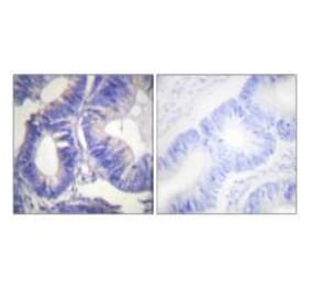 Immunohistochemistry - NCK2 Antibody from Signalway Antibody (33447) - Antibodies.com