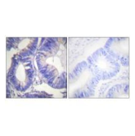 Immunohistochemistry - NCK2 Antibody from Signalway Antibody (33447) - Antibodies.com