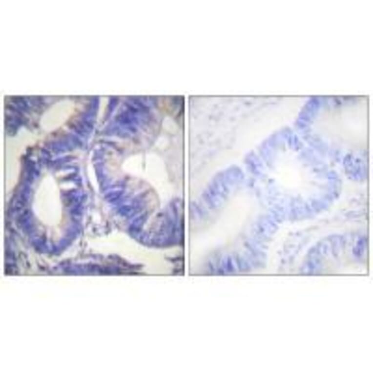 Immunohistochemistry - NCK2 Antibody from Signalway Antibody (33447) - Antibodies.com