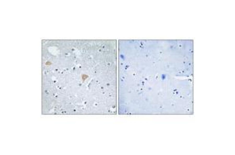 Immunohistochemistry - CTRO Antibody from Signalway Antibody (33565) - Antibodies.com