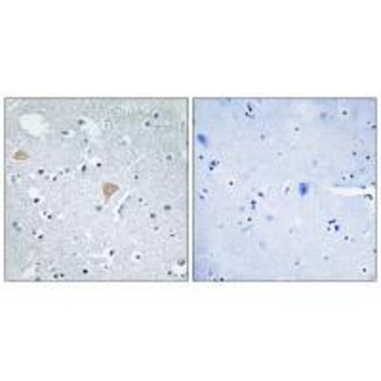 Immunohistochemistry - CTRO Antibody from Signalway Antibody (33565) - Antibodies.com
