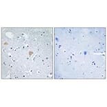 Immunohistochemistry - CTRO Antibody from Signalway Antibody (33565) - Antibodies.com
