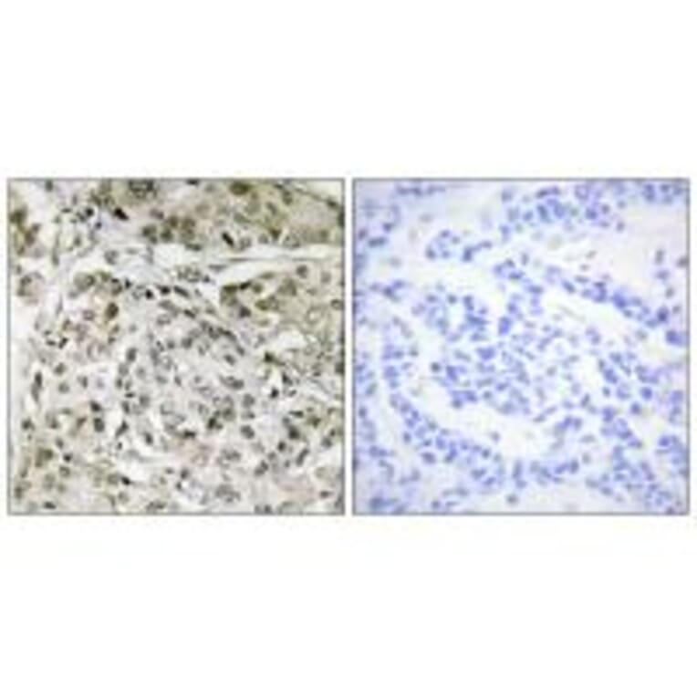 Immunohistochemistry - TAF1 Antibody from Signalway Antibody (33715) - Antibodies.com