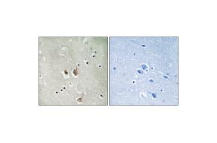 Immunohistochemistry - CKS2 Antibody from Signalway Antibody (33755) - Antibodies.com