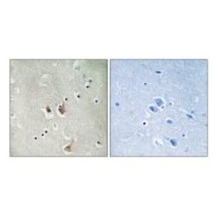 Immunohistochemistry - CKS2 Antibody from Signalway Antibody (33755) - Antibodies.com