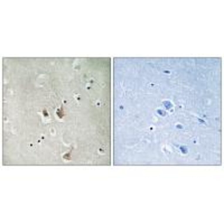 Immunohistochemistry - CKS2 Antibody from Signalway Antibody (33755) - Antibodies.com
