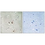 Immunohistochemistry - CKS2 Antibody from Signalway Antibody (33755) - Antibodies.com