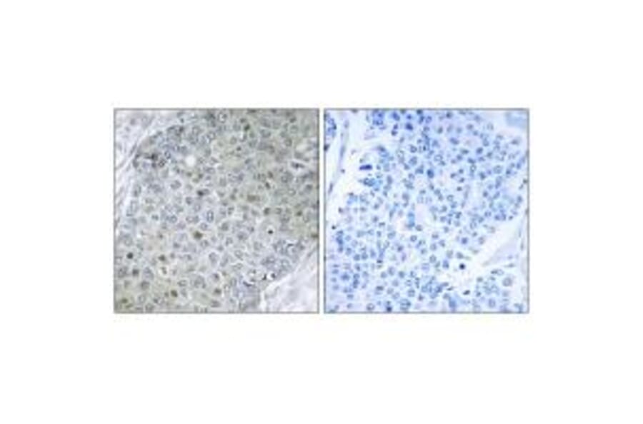 Immunohistochemistry - ETV4 Antibody from Signalway Antibody (33772) - Antibodies.com