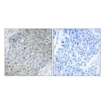 Immunohistochemistry - ETV4 Antibody from Signalway Antibody (33772) - Antibodies.com