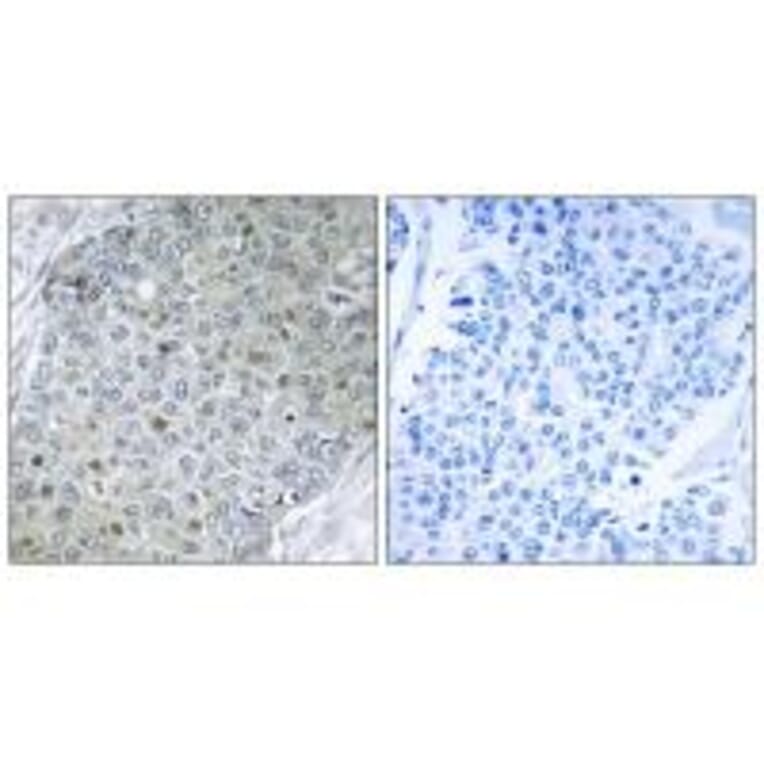 Immunohistochemistry - ETV4 Antibody from Signalway Antibody (33772) - Antibodies.com