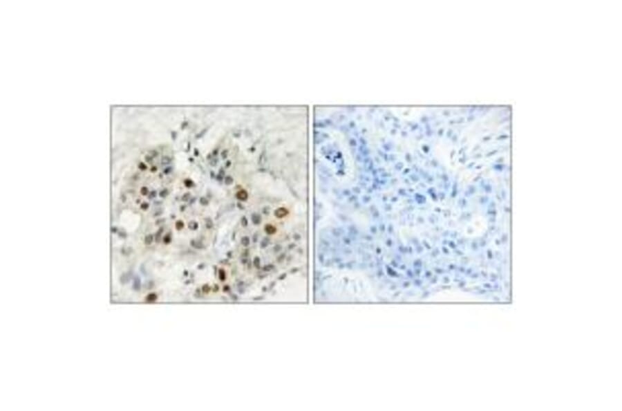 Immunohistochemistry - AF4 Antibody from Signalway Antibody (33800) - Antibodies.com