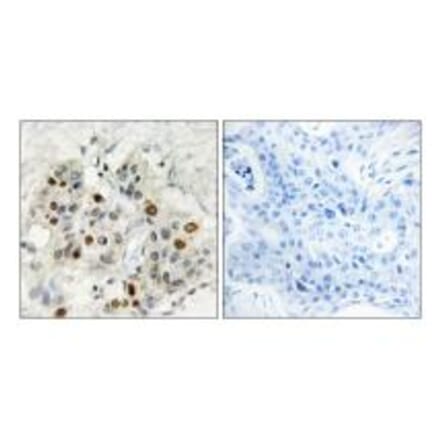 Immunohistochemistry - AF4 Antibody from Signalway Antibody (33800) - Antibodies.com