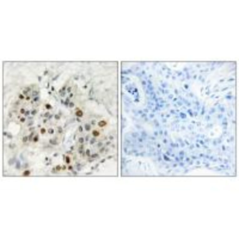 Immunohistochemistry - AF4 Antibody from Signalway Antibody (33800) - Antibodies.com