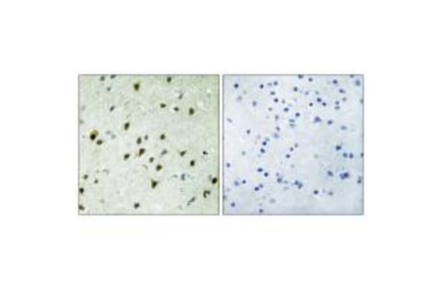 Immunohistochemistry - MAD4 Antibody from Signalway Antibody (33882) - Antibodies.com