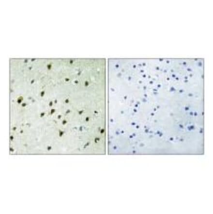 Immunohistochemistry - MAD4 Antibody from Signalway Antibody (33882) - Antibodies.com