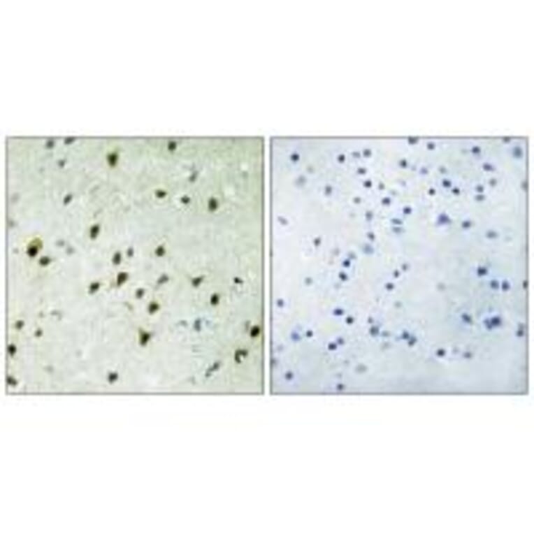 Immunohistochemistry - MAD4 Antibody from Signalway Antibody (33882) - Antibodies.com