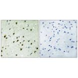 Immunohistochemistry - MAD4 Antibody from Signalway Antibody (33882) - Antibodies.com