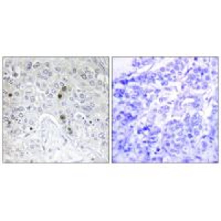 Immunohistochemistry - BATF Antibody from Signalway Antibody (33911) - Antibodies.com