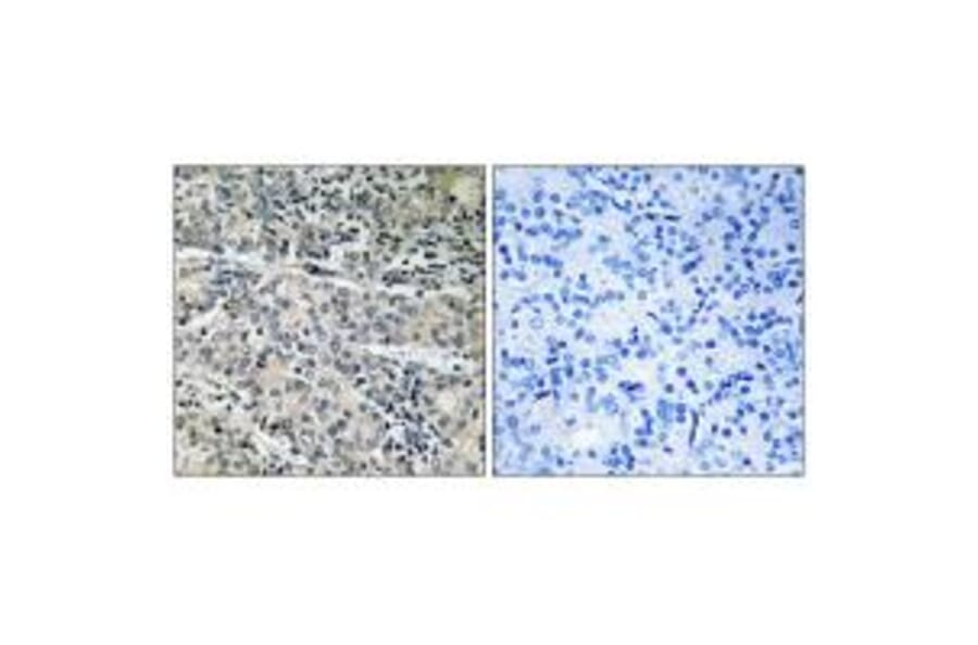 Immunohistochemistry - MP68 Antibody from Signalway Antibody (34343) - Antibodies.com