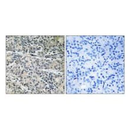 Immunohistochemistry - MP68 Antibody from Signalway Antibody (34343) - Antibodies.com