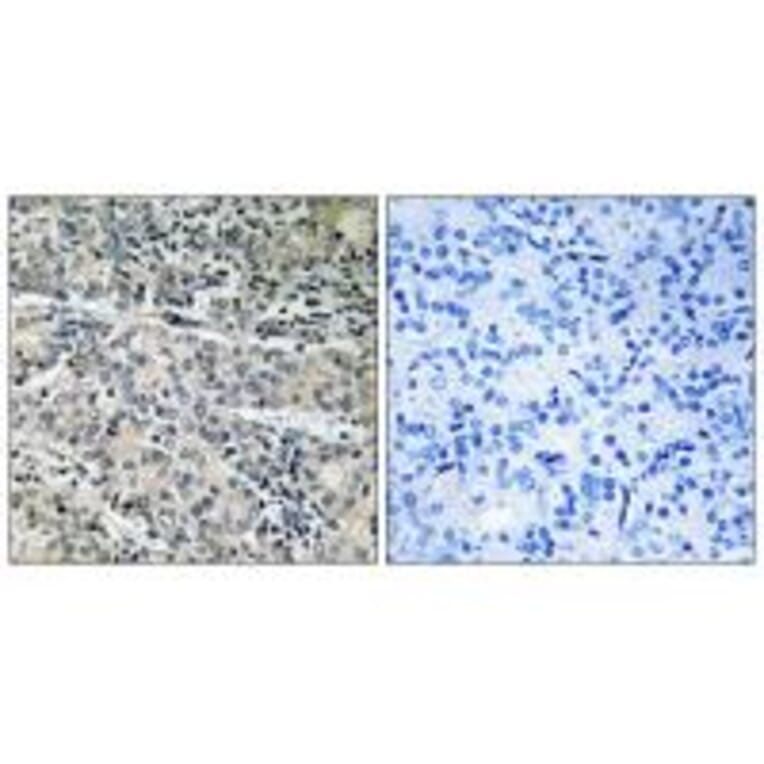 Immunohistochemistry - MP68 Antibody from Signalway Antibody (34343) - Antibodies.com