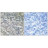 Immunohistochemistry - MP68 Antibody from Signalway Antibody (34343) - Antibodies.com