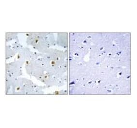 Immunohistochemistry - FMN2 Antibody from Signalway Antibody (34687) - Antibodies.com