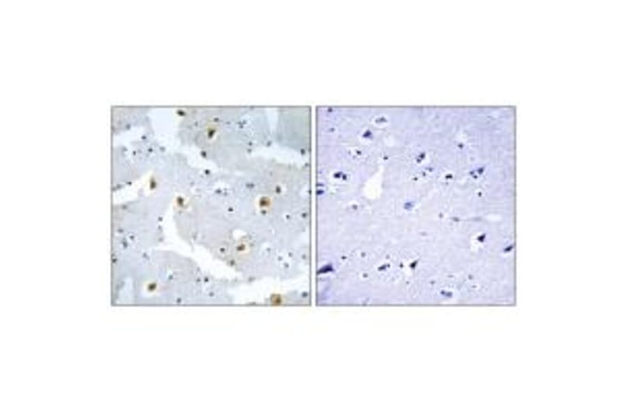 Immunohistochemistry - FMN2 Antibody from Signalway Antibody (34687) - Antibodies.com