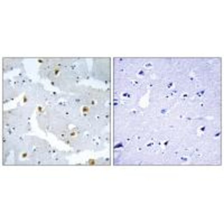 Immunohistochemistry - FMN2 Antibody from Signalway Antibody (34687) - Antibodies.com