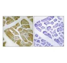 Immunohistochemistry - MYH4 Antibody from Signalway Antibody (34820) - Antibodies.com