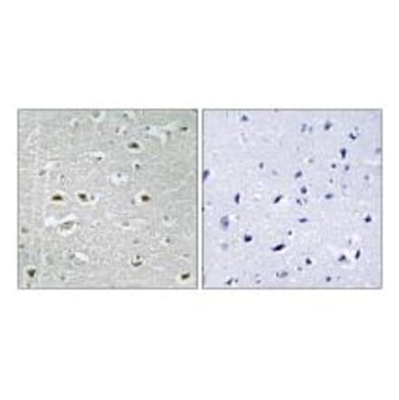 Immunohistochemistry - URB1 Antibody from Signalway Antibody (34877) - Antibodies.com