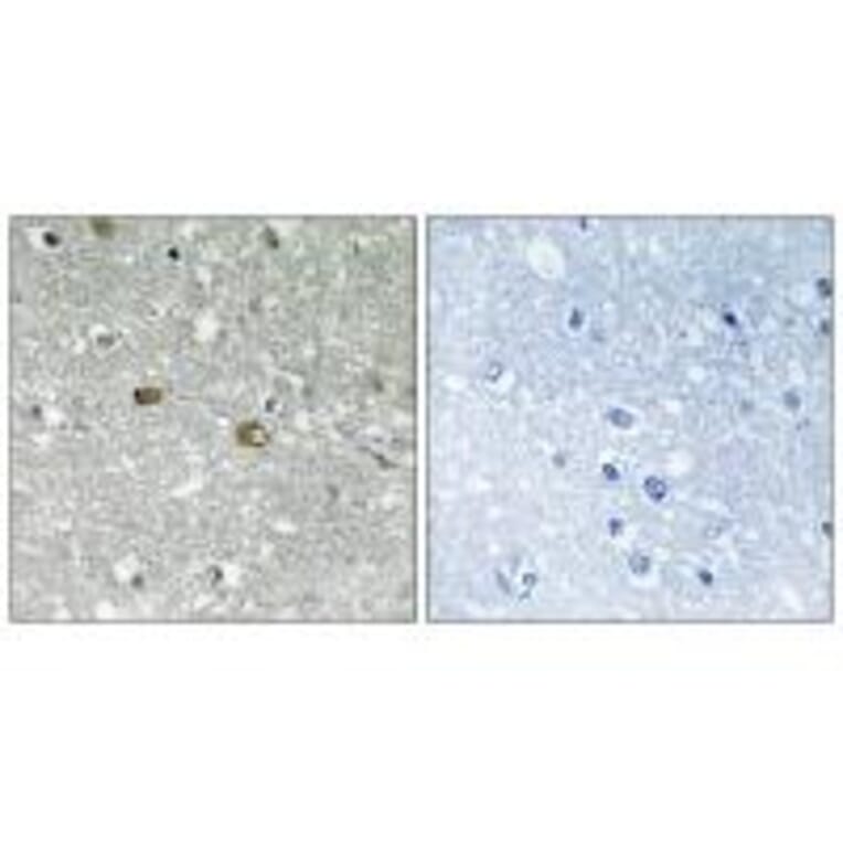 Immunohistochemistry - PIGH Antibody from Signalway Antibody (34901) - Antibodies.com