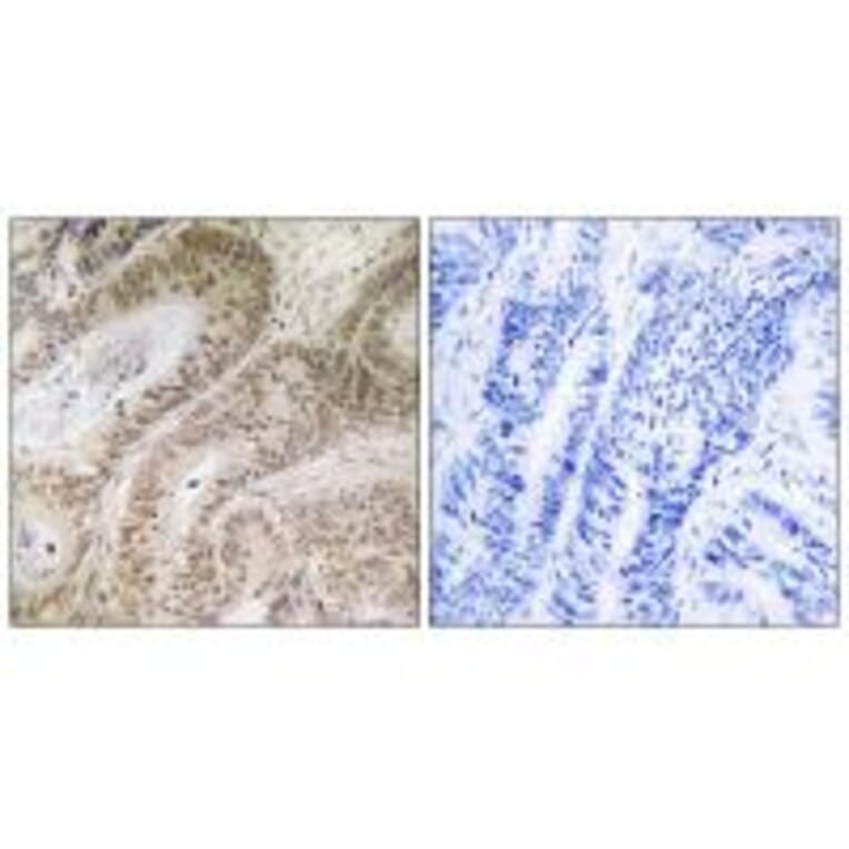 Immunohistochemistry - RDM1 Antibody from Signalway Antibody (34953) - Antibodies.com
