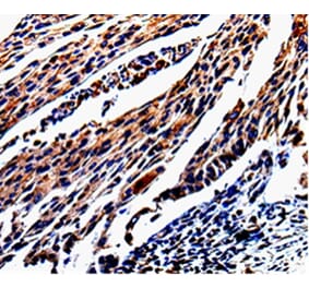 Immunohistochemistry - KLK3 Antibody from Signalway Antibody (35547) - Antibodies.com