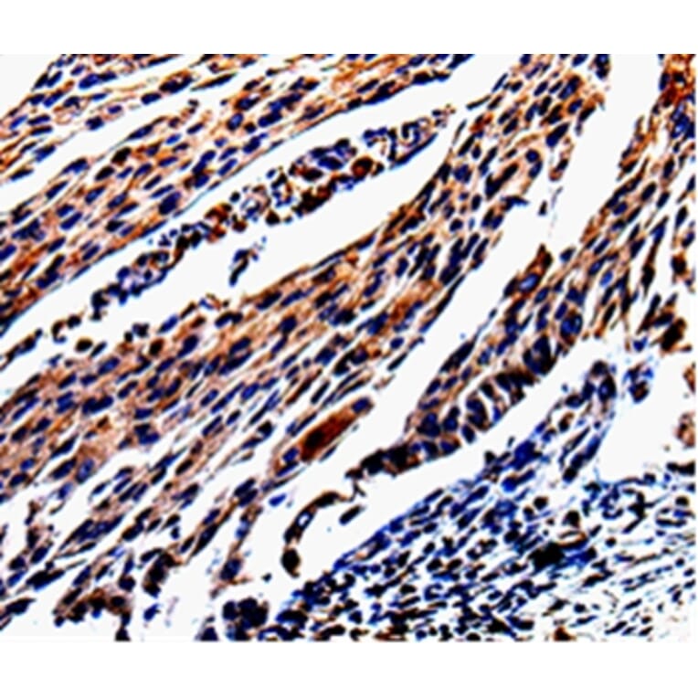 Immunohistochemistry - KLK3 Antibody from Signalway Antibody (35547) - Antibodies.com